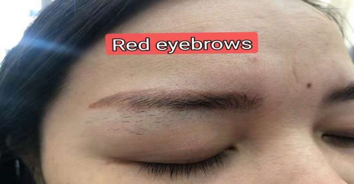 5 Reasons Why Correcting Red and Blue Eyebrows Is Essential